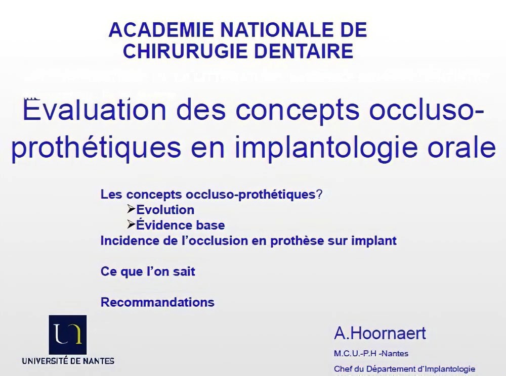 Implantologie dentaire et occlusion