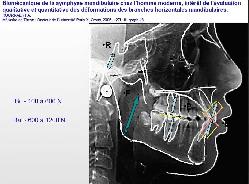 Implantologie dentaire et occlusion