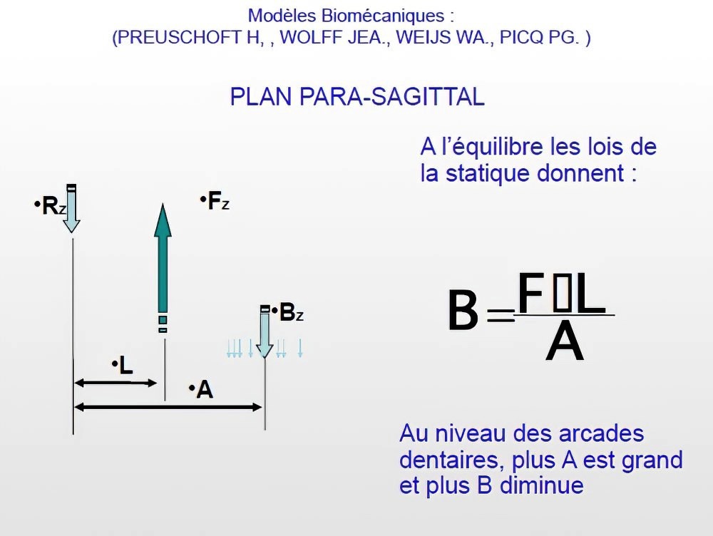 Implantologie dentaire et occlusion