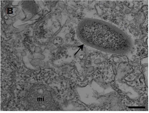 Paro médicale protozaires Amoebae-resisting Bacteria